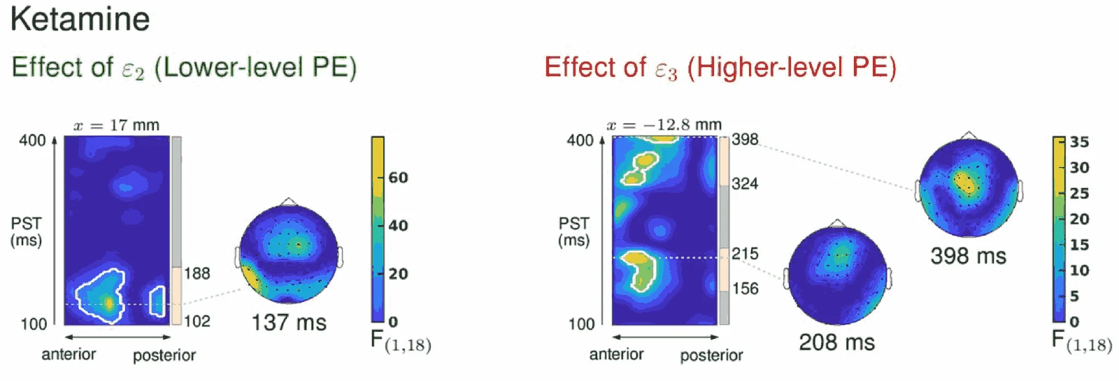 The dual role of ketamine: a computational perspective on pharmacological interventions in psychiatry